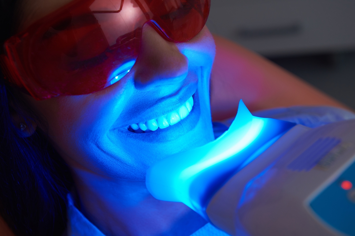 teeth-whitening-in-Matthews