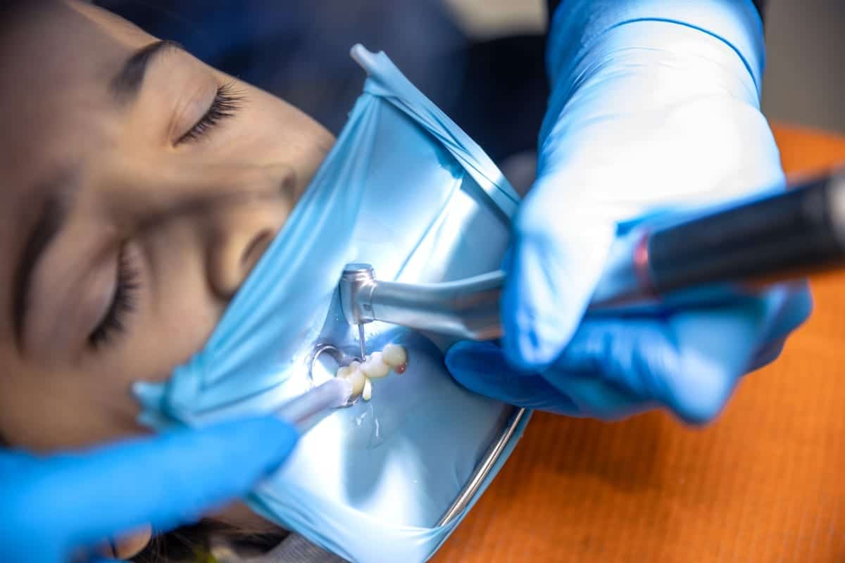 Root Canal Treatment in Matthews