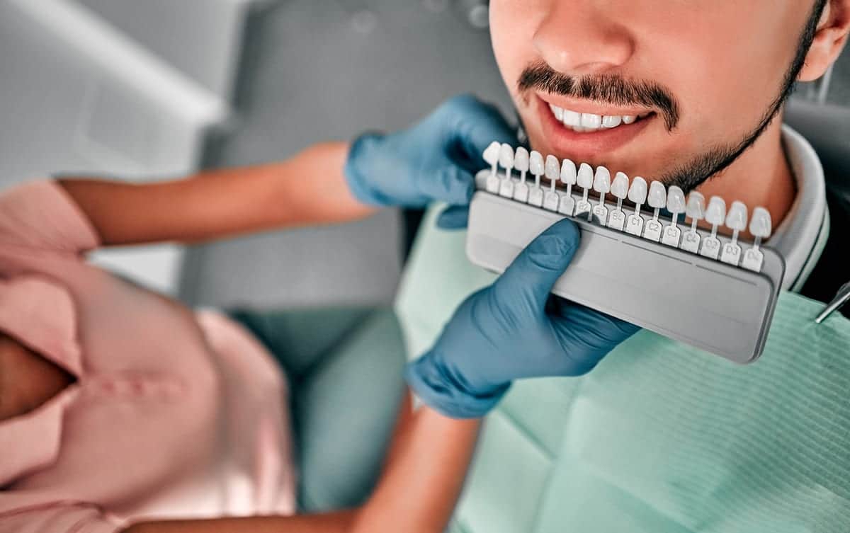 Veneers in Matthews